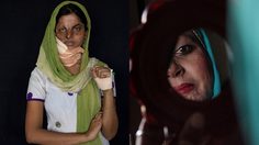 เหมือนตายทั้งเป็น! เหยื่อน้ำกรด ยอมเปิดเผยหน้าเสียโฉม รณรงค์หยุดทำร้ายผู้หญิง