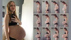 มหัศจรรย์! ท้องแฝดสาม โดยไม่ได้พึ่งคุณหมอ โอกาสแค่ 1 ใน 4,400