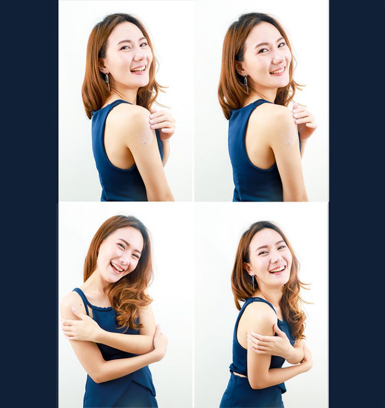 วิธีทำให้ผิวขาว