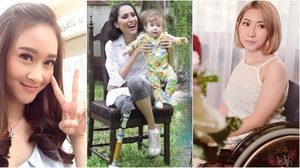3 สาวหัวใจเพชร ไร้ขา แต่ใช้ใจเดินต่อ เมื่อแปลงความสูญเสีย เป็นพลังแห่งชีวิต