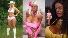 อดีตแอร์โฮสเตสผิวขาว ลงทุน 2.2 ล้าน ฉีดสีผิว อัพนมไซส์ยักษ์ สวยๆ สไตล์แอฟริกัน