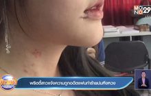 พริตตี้สาวแจ้งความถูกอดีตแฟนทำร้ายปมหึงหวง