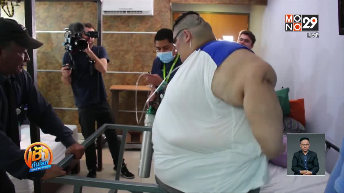 ชายอ้วนที่สุดในโลกเข้ารับการผ่าตัดลดน้ำหนัก