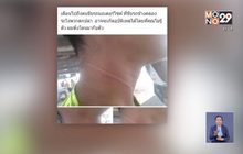 อุทาหรณ์คนตกปลาตวัดสายเบ็ด รัดคอหนุ่มขี่จักรยานยนต์