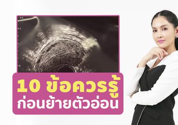 10 ข้อควรรู้ ในการเตรียมตัวก่อนย้ายตัวอ่อนสู่โพรงมดลูก สำหรับผู้ที่ทำเด็กหลอดแก้ว