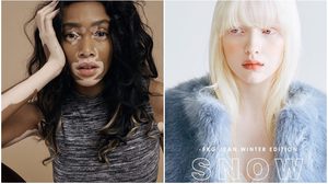 7 สาว ‘สีผิว’ แปลกไม่เหมือนใคร จากปมด้อย ตอนนี้กลายเป็น คนดังระดับโลก!