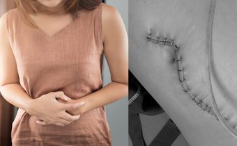 อุทาหรณ์​ เรื่องอั้นฉี่ ภัยร้ายสุขภาพที่หลายคนมองข้าม รุนแรงกว่าที่คิด!