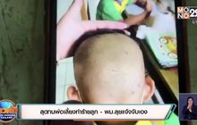 สุดทนพ่อเลี้ยงทำร้ายลูก – พม.ลุยแจ้งจับเอง