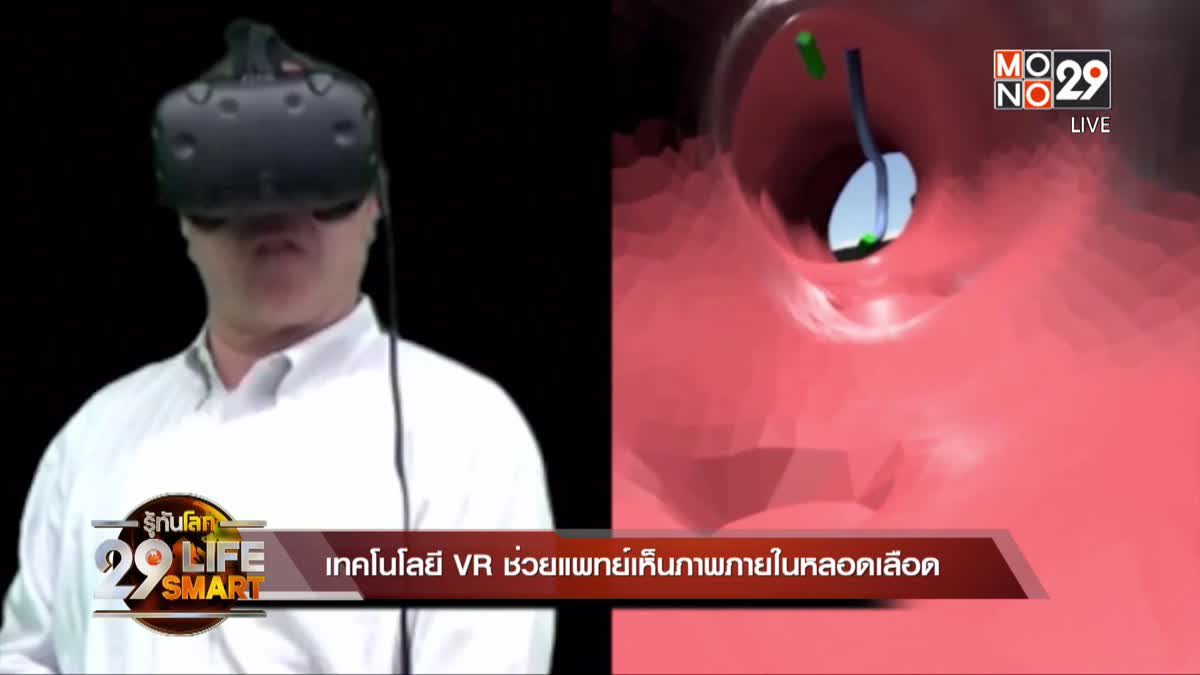 29 LifeSmart : เทคโนโลยี VR ช่วยแพทย์เห็นภาพภายในหลอดเลือด