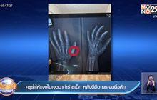 ครูร่ำไห้แจงไม่เจตนาทำร้ายเด็ก หลังตีมือ นร.จนนิ้วหัก