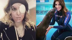 ความสวยเอาไป ขอดวงตาไว้ก็พอ! อดีตนางงาม ถูกสาดน้ำกรด ไม่ท้อขอกลับมาทำงานต่อ