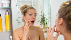 5 วิธีรักษาสิวอักเสบ รับมือยังไงให้หน้ากลับมาสวยเหมือนเดิม ปลอดภัย 100%