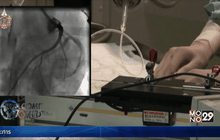 นวัตกรรมกล้องจิ๋วเพื่อการรักษาโรคหัวใจ