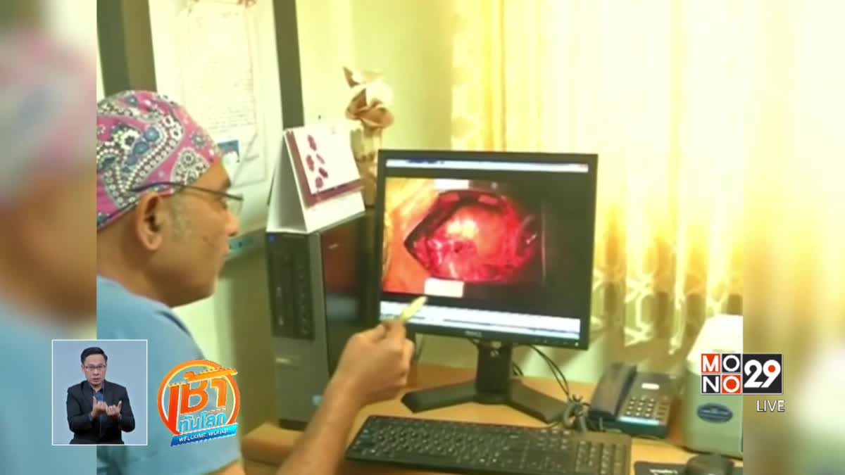 แพทย์อินเดียปลูกถ่าย "หัวใจดวงที่ 2" ให้ผู้ป่วย