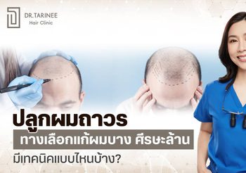 ปลูกผม รักษาผมบาง ศีรษะล้านดีไหม มีเทคนิคปลูกผมอะไรบ้าง?
