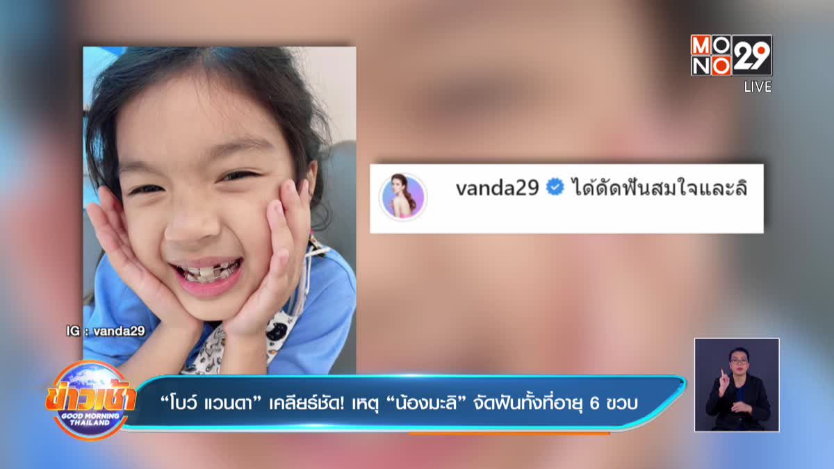 “โบว์ แวนดา” เคลียร์ชัด! เหตุ “น้องมะลิ” จัดฟันทั้งที่อายุ 6 ขวบ