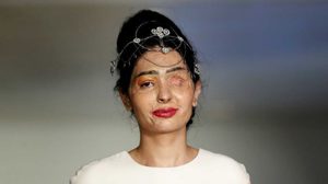 สาวอินเดีย เหยื่อสาดน้ำกรด เฉิดฉายบนเวที นิวยอร์คแฟชั่นวีค!