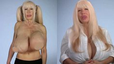 อุทาหรณ์สอนใจ! ดาวโป๊ ศัลยกรรมหน้าอกคัพโอ กับหมอเถื่อน ติดเชื้อหวิดนมเน่า!