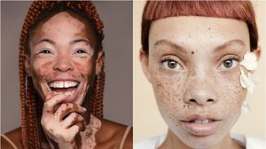 โนสน โนแคร์! รวม 17 นางแบบแปลก ไม่สวยเป๊ะ แต่เริ่ดระดับโลก