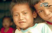 เด็กฟิลิปปินส์ 1 ใน 3 อยู่ในภาวะแคระแกร็น