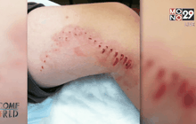 ชาวอเมริกันหวั่นฉลามบุกรุกหาดฝั่งตะวันออก