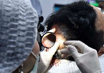 ปลูกผมที่ไหนดี? ราคาไม่แพง