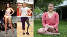 ยิ้มสู้! สาวงามเวทีขาอ่อน ป่วย โรคมะเร็ง ชีวิตพลิกต้องใช้ชีวิตกับขาที่กลับด้าน 180 องศา