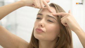 7 วิธีรักษาสิวอุดตัน ไม่ให้อักเสบ รับมือให้ถูก แล้วจะไม่กลับมาเป็นอีก