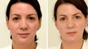 เธอคนนี้ ดื่มน้ำ กว่า 3 ลิตรทุกวัน กับผลลัพธ์ที่ได้ สุดน่าทึ่ง!!!