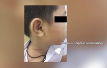 ผอ.ตบ “เด็กพิเศษ” แก้วหูทะลุ