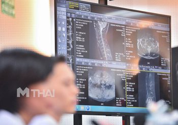 หมอแถลง อาการตูน บอดี้สแลม พบหมอนรองกระดูกคอทับเส้นประสาท 2 ข้อ