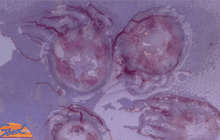 นทท.เยอรมันโดนพิษแมงกะพรุนกล่อง ดับ 1 ราย