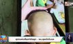 สุดทนพ่อเลี้ยงทำร้ายลูก – พม.ลุยแจ้งจับเอง