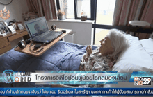 โครงการวิดีโอช่วยผู้ป่วยโรคสมองเสื่อม