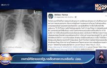 แพทย์ศิริราชขอรัฐบาลสื่อสารความจริงกับ ปชช.