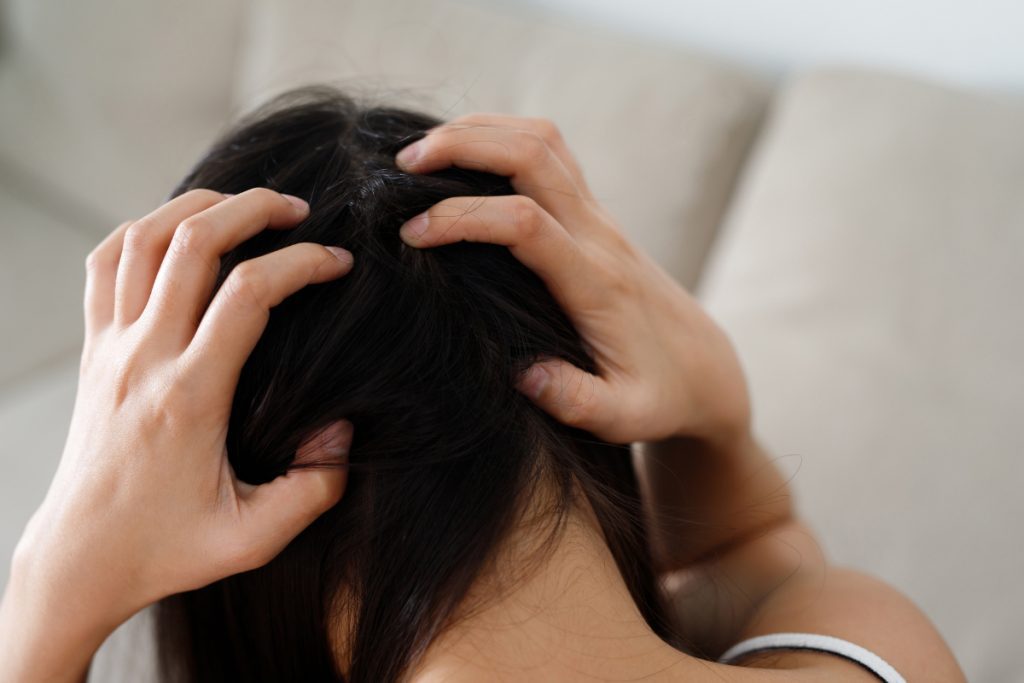 แพ้แชมพู