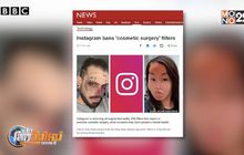 อินสตาแกรม แบนฟิลเตอร์ “ศัลยกรรมหน้า”