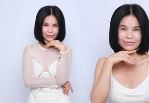 รุ้งลาวัลย์ เปิดใจได้เวลาศัลยกรรม!! ย้อนอายุใบหน้าด้วย Face Lock และ Facial Contour หวังสตาฟหน้าหนูหิ่น