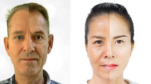 เป๊ะก่อนใคร! ส่อง เทรนด์ศัลยกรรม มาแรง ในปี 2018