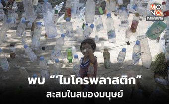 นักวิทย์พบ ‘ไมโครพลาสติก’ สะสมลึกในสมองมนุษย์