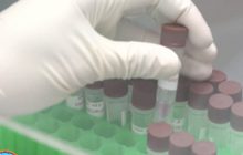 สธ.แจงปมผลตรวจ “แล็บยะลา” ผิดพลาด 40 ราย