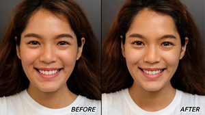 HappyNancy เล่าประสบการณ์ให้อาหารผิว และ Hifu เจ็บเหมือนช้างเหยียบหน้า แต่เห็นผล!!