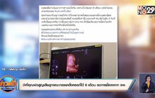 ว่าที่คุณพ่อสูญเสียลูกขณะภรรยาตั้งครรภ์ได้ 6 เดือน รอการชี้แจงจาก รพ.