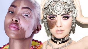 แปลกแต่แซ่บ! 13 นางแบบระดับโลก ปฏิวัติวงการแฟชั่น