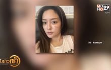 “แก้มบุ๋ม” หวิดเสียโฉมถูกแมวข่วนหน้า แย้มหัวใจไม่ว่าง