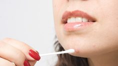 สิวขึ้น แต่ละที่ บ่งบอกความผิดปกติของร่างกาย ได้ด้วยนะ