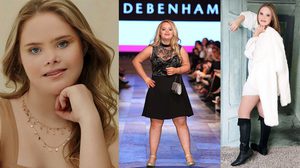 แตกต่างแต่เท่าเทียม สาวดาวน์ซินโดรม เดินตามฝัน เซ็นสัญญาโมเดลลิ่ง ถึง 5 ค่าย