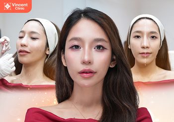 ฟิลเลอร์ คืออะไร อันตรายไหม มีผลข้างเคียงอะไรบ้าง เหมาะกับใคร?