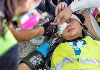 เผยคลิปนาทีตำรวจฮ่องกงยิงนักข่าวหญิงชาวอินโดนีเซียจนตาบอด