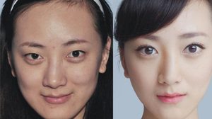 ศัลยกรรม Before & After สาวจีน เค้าก็บ้าศัลยฯ ไม่แพ้กันนะจ๊ะ